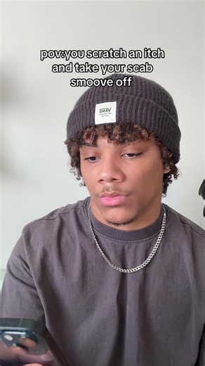 idk if this is funny or not lol #fypシ | scab