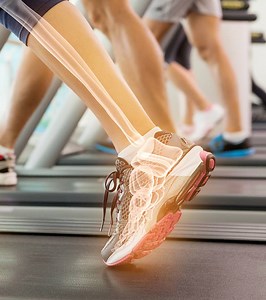 Osteopenia Diet: Complete Guide To Strengthen Bones Naturally