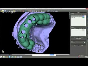 Guide Fabrication Techniques using Blue Sky Plan (1 CE, no charge)