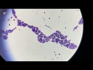 Difference between yeast and cocci under a light microscope #foryou