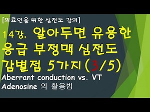Lesson 14. 5 Useful ECG Arrhythmia Facts You Should Know (Part 3 of 5): Aberrant Conduction and VT