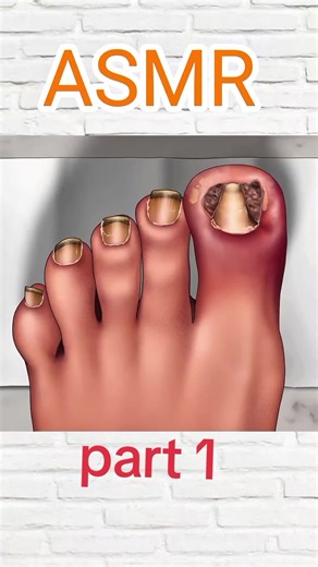 ASMR Treatment for Relaxation - Part 1