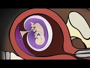 1st Trimester: Surgical Abortion - Suction Aspiration (D & C)