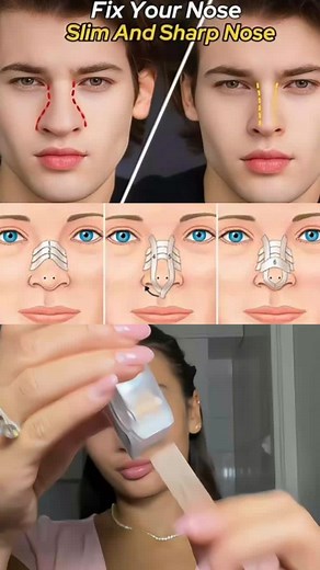 nose taping tutorial #nosejobs #beautyhack #GlowUp #selfimprovement #looksmax