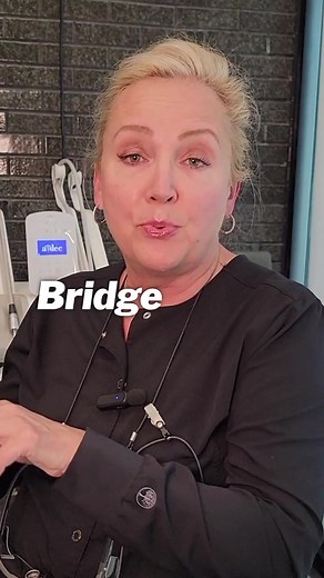 ⚠️The longer you wait to replace a missing tooth, the bigger the risks. It isn’t just a good idea but a necessity to replace missing or broken teeth. Bridges are porcelain restorations made to replace one or more teeth in a row. They are created with a false tooth called a pontic fused to a dental crown on each side. This restoration requires that patients have teeth on each side of the missing tooth to anchor the bridge in place. Follow us to learn more about Natural and Cosmetic Dentistry! #de