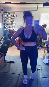 Maybe an unpopular opinion, but not all plastic surgery is for perfection. And if that’s the goal, especially when there is major scarring involved then it might not be for you. I always cared more about comfort and how I felt in my body than about any scars! Same thing goes for stretch marks! There are still areas with looseness and folds and that’s okay! It doesn’t make my body not amazing and strong! 💪🏼🙌🏼 #weightlosstransformation #weightlossjourney #looseskinremoval #looseskin #armlift #