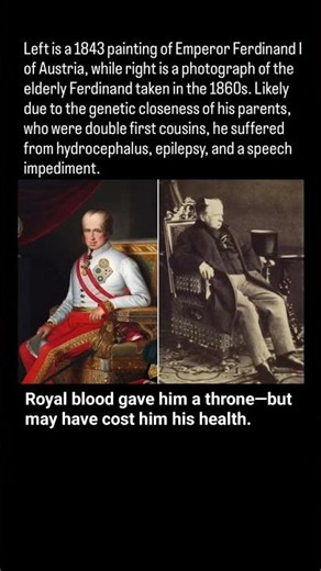 The Austrian Emperor Whose Family Tree Became a Warning 😳👑