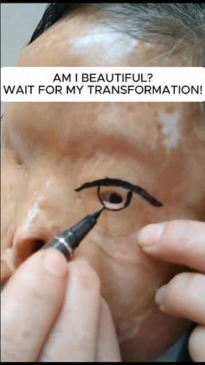 Beauty Behind the Scars: A True Story of Self‑Love