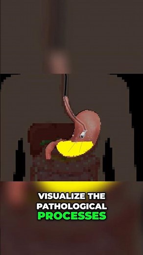 Shocking Medical Complication😱