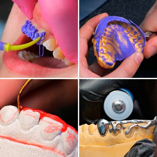 3.9M views · 4.8K reactions | Stunning teeth jewelry for girls from professionals! | 5-Minute Crafts Play | Facebook