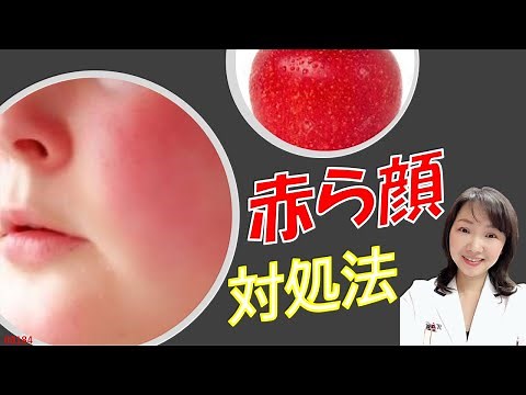 赤ら顔（赤面症）の原因とその対策～スキンケアのポイントは？肌状態はどんな感じなの？