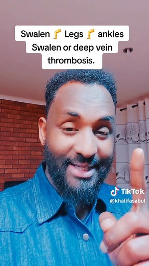 Understanding Peripheral Edema: Causes and Symptoms