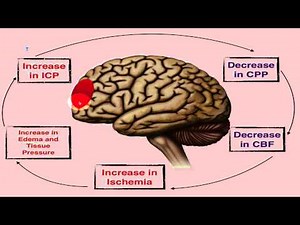 Increased Intracranial Pressure - ICP - EMTprep.com