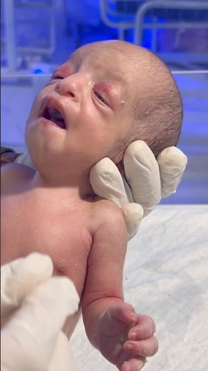 Newborn Baby Oil Massage & Physiotherapy | Gentle Care & Healing Moments 👶💆‍♂️ #NewbornBabyCare