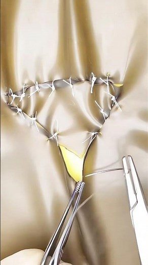 Catastrophic Laceration Repair 😷😯 #goodtoknow #funfacts #surgeonlife #suturing #vet #medicine