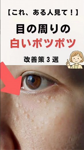 目の周りの白いポツポツ改善法 #健康雑学 #美肌 #体質改善 #稗粒腫# #健康