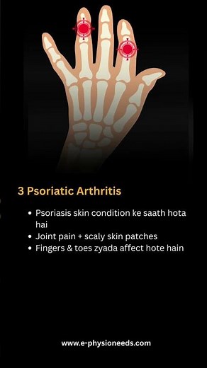 5 Types of Arthritis You Must Know