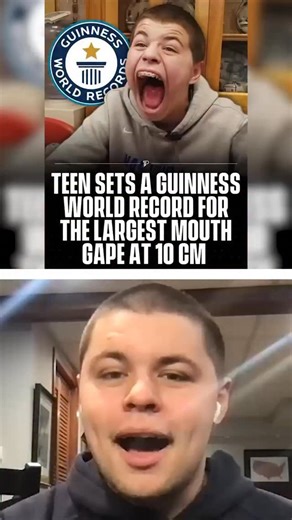 Pubity on Instagram: "Meet the kid with the world’s largest mouth gape 😮 Isaac Johnson has set a Guinness World record for the largest mouth gape, measuring over 4 inches at 10.196cm. The record has taken him around the country appearing on America’s Got Talent, Jimmy Kimmel Live and even acting in skits with Danny Trejo and Brett Rivera. Isaac told us exactly how the record has changed his life and what his dentist makes of his new star client."