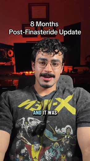 OneHot on Instagram: "Why I quit finasteride 8 months ago — #lastofthenattys #hairloss #finasteride #dutasteride #minoxidil #androgenicalopecia #malepatternbaldness #malepatternhairloss #hairlosstreatments"