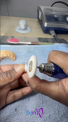 Veneers Made with Ivoclar e.max CAD