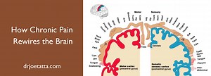 How Chronic Pain Rewires the Brain and 5 Proven Ways to Reverse It - INTEGRATIVE PAIN SCIENCE INSTITUTE