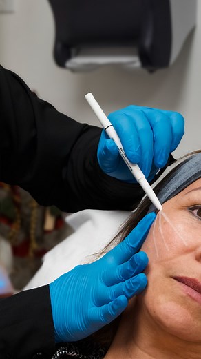 3.7K views · 29 reactions | ✨ Viví la nueva era del antienvejecimiento en Dolce Medical ✨ Con Radiesse, estimulás la producción natural de colágeno y lográs una piel más firme, rejuvenecida y con resultados duraderos.  Una tecnología que ya forma parte de nuestros tratamientos estrella. Agendá tu cita y descubrí cómo realzar tu belleza de forma natural  | Dolce by Dr. Allan Pérez | Facebook