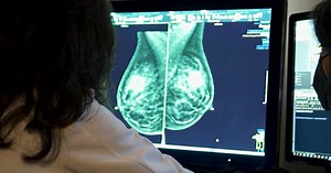 New breast cancer screening guidelines