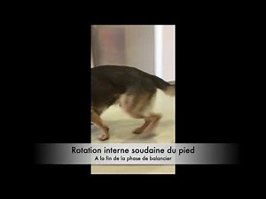 Gracilis contracture