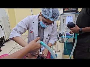 Superficial parotidectomy under general anesthesia #anesthesia