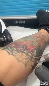 New laser tatto removal PicoSure - CynoSure from “Kostas Beauty Center“25935279 - 22262750 - 99492913 see results from our website : http://www.kostashair.com/beauty-center/laser-tattoo-removal | Kostas Laser Center