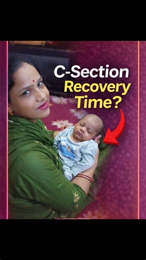 C-Section ke Taanke Kitne Din Mein Theek Hote Hain? | Cesarean Recovery Tips #shorts