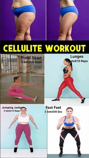 Cellulite Workout | Reduce Cellulite | Cellulite Exercise
