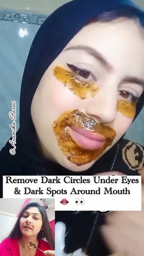 1M views · 5.4K reactions | Remove Dark Circles Under Eyes/Remove Dark Spots Around Mouth #shorts #skincare #darkcircles #darkspots #skincaretips #youtubeshorts #fbreels #viralreels #trendingreels #fbviralreels #viralreelsシ #viralreelsfb #reelsviralfb #fbviral #reelsviral #reels2025 | Anamika Barai | Facebook