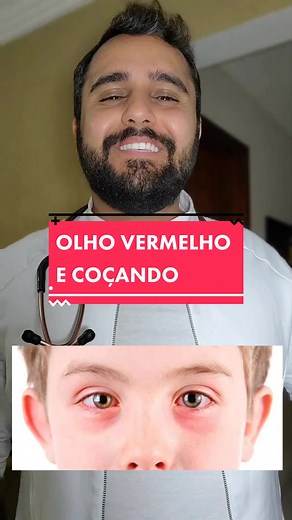 Entendendo a Conjuntivite: Sintomas e Dicas