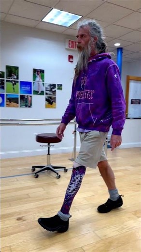 Symes Amputee Walking with a Prosthetic Leg: Socket Design