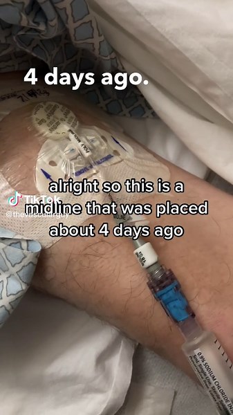 👉@thevascularguy 👈How long do your Midlines last? #vascularaccess #medstudent #medschool #nursingstudent #nursingschool #newgrad #newgradnurse #criticalcare #criticalcarenurse #criticalcaremedicine #ernurse #erdoctor #emergencymedicine #emergencyroom #interventionalvascularaccess #interventionalradiology #criticalcaredoctor