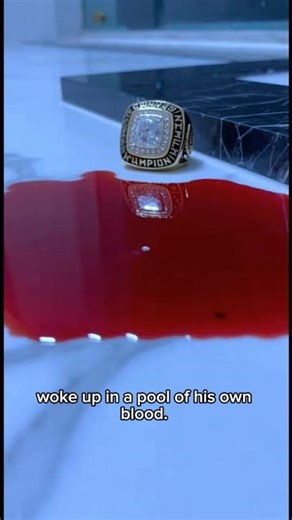 Life Threatening Blood Clots: Do This Vascular Audit Right Now