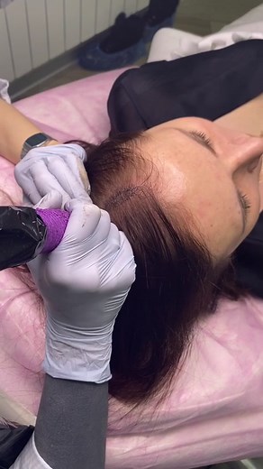 #рек #трихо #хочуврек #минск