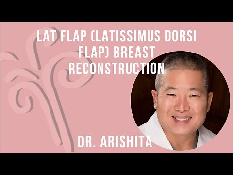 LAT Flap (Latissimus Dorsi Flap) Breast Reconstruction