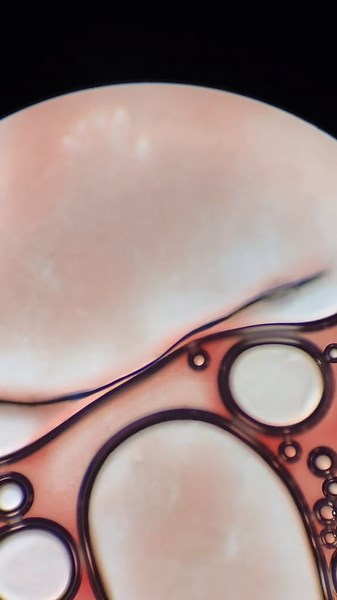 The Effects of Peroxide on Tissues | Microscope Science