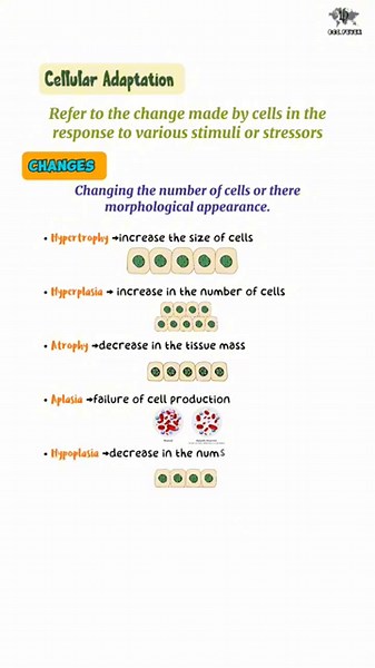 Cellular Adaptation #hyperplasia#hypertrophy#atrophy#cell#adaptation#pathology#usmle#mbbs#medical