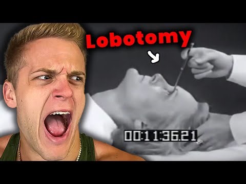The DUMBEST Surgery In History.