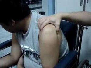 Multidirectional Instability In A Drawer Examination • Video • MEDtube.net