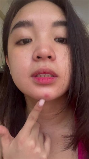 Effective Acne Control and Pore Cleansing Solutions