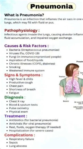 Pneumonia.Important points to know in 1 minute.#education#knowledge#blood#med#laboratory#pneumonia