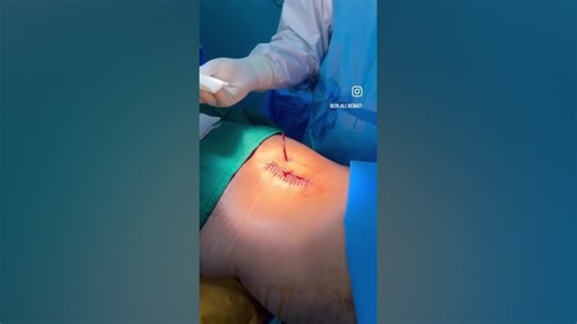 آموزش پانسمان در منزل