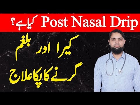 Post Nasal Drip and Sinus Congestion | Fast Relief Methods Explained کیرا