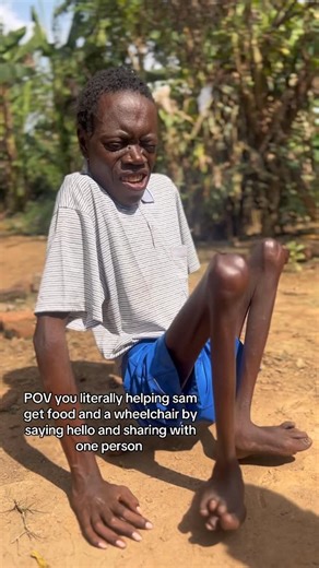 Helping hands on Instagram: "I wish this video catches your attention and you stay 10 seconds of your time to help Sam get a wheelchair and fight this pain"