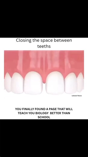 Close Teeth Gaps Fast! #shorts #teeth #medical