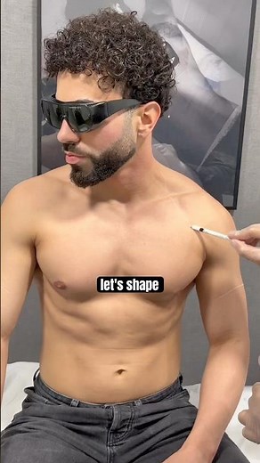 Candela Laser Hair Removal For Men ⚡️ #beardlaser #ytshorts #mansculpt #laserhairremoval #candela